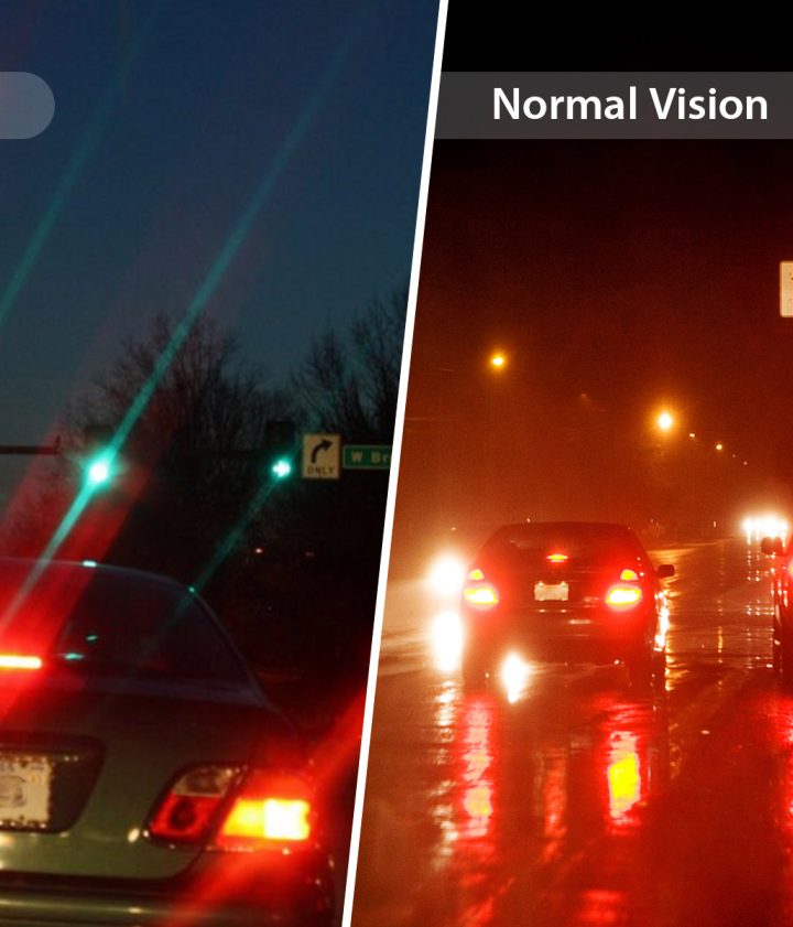 What is Astigmatism and How Could You Fix It?