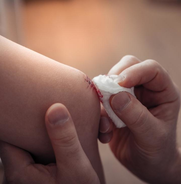 How to Make a Would Heal Faster