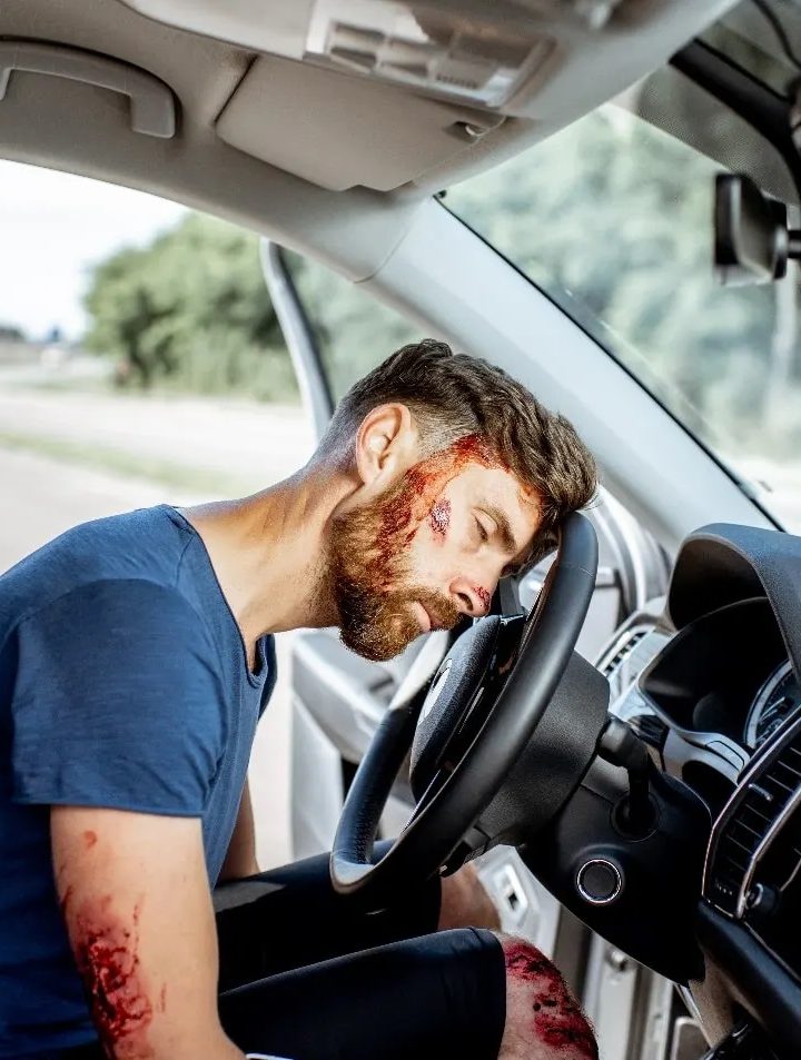 What are the Different Types of Brain Injuries Sustained in Car Accidents in Kent?