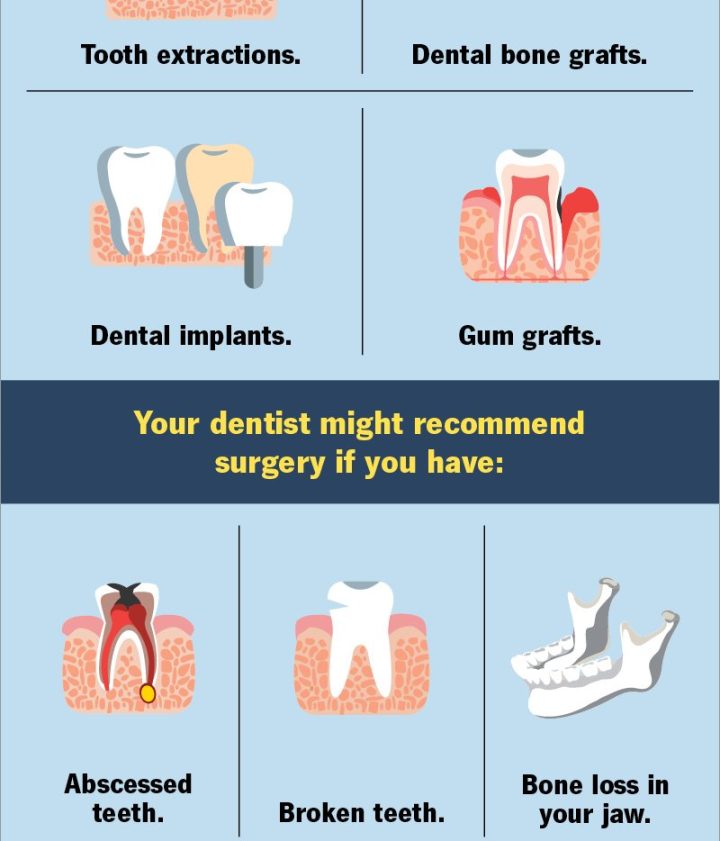 Expert Guide: How Long Does Oral Surgery Take