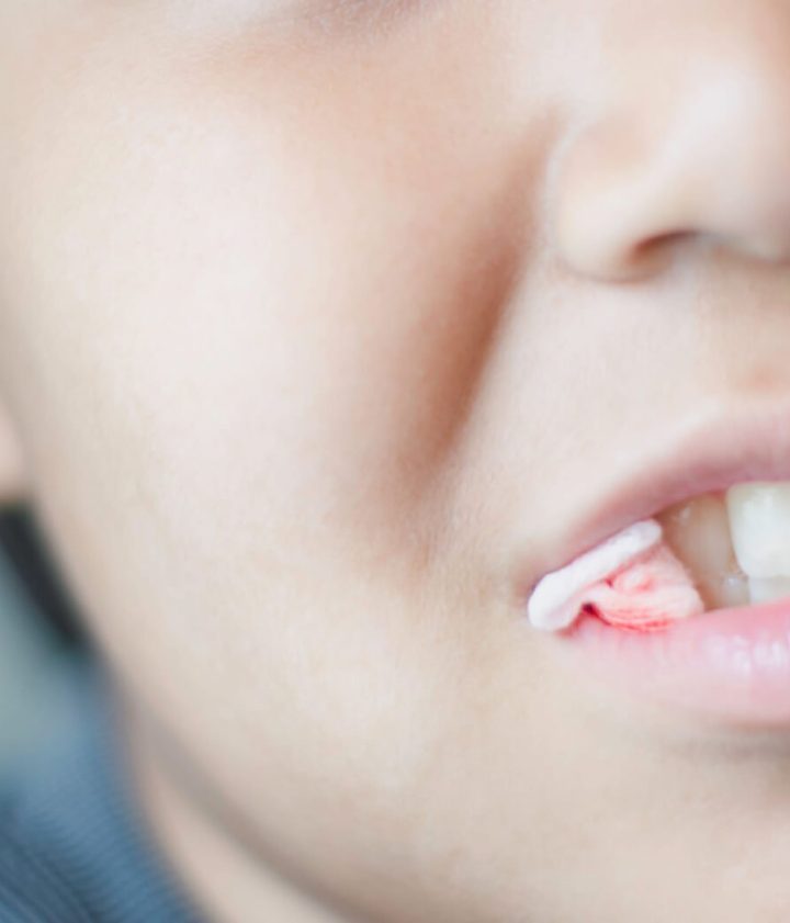 How Long Should You Keep Gauze In After Tooth Extraction: Expert Tips