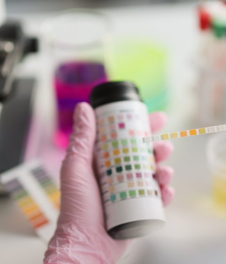 Cost Of Urine Drug Test: How Much Does A Urine Drug Test Cost